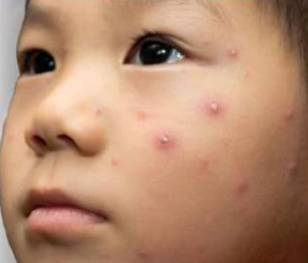 Hình minh họa câu hỏi